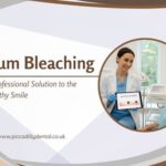 Laser gum bleaching treatment in London