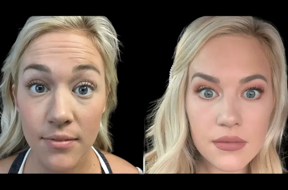 The Rise of Advanced Aesthetic Technology at the Best Aesthetic Clinic in Dubai