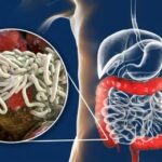 Fenbendazole 1000 Mg – Trusted Relief from Digestive Worm Infections