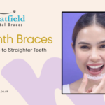 Six Month Braces: The Fast Lane to Straighter Teeth