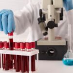 The Importance of Hematology Labs in Public Health Initiatives