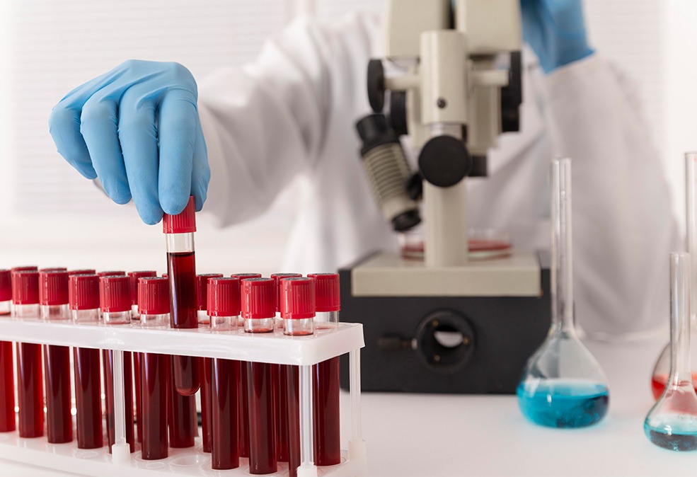 The Importance of Hematology Labs in Public Health Initiatives