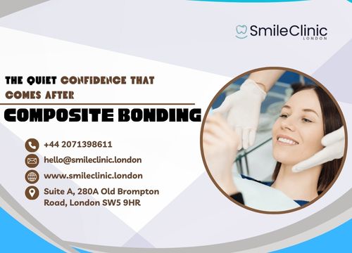 Dental composite bonding London