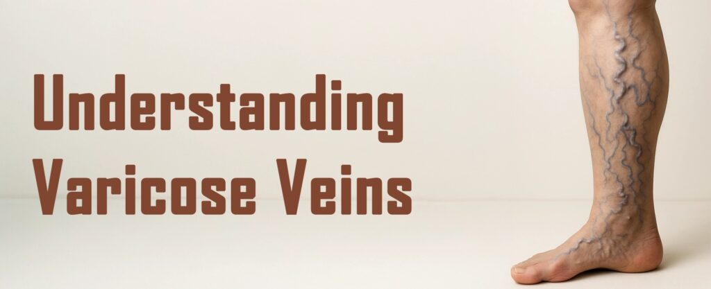 varicose veins specialist in ahmedabad
