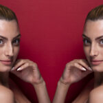 botox before and after pics